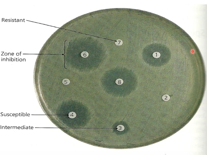 <p>Disk Diffusion/Kirby Bauer Test</p>
