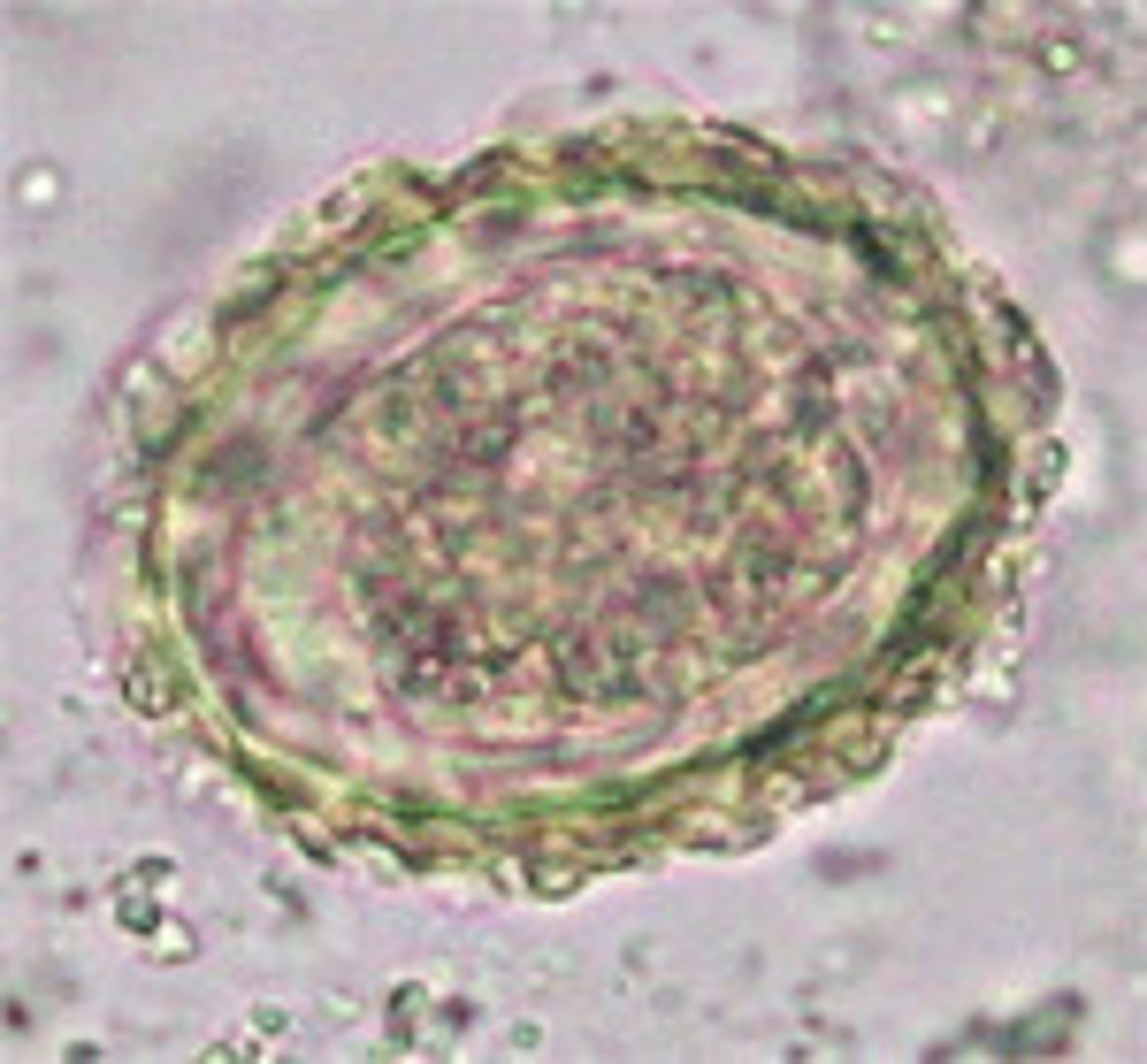 <p>Swine roundworm</p>
