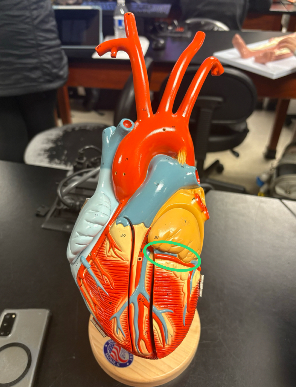 <p>splits left atrium/ventricle</p>