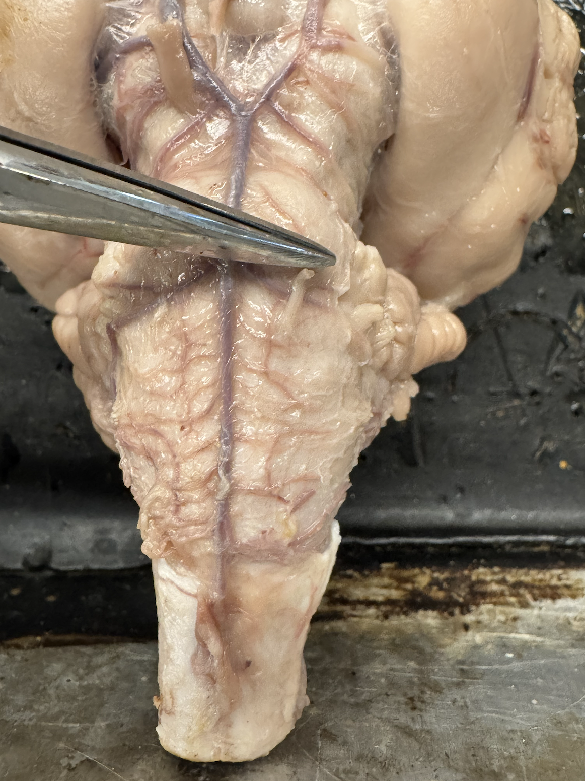 <p>what nerve is this?</p>