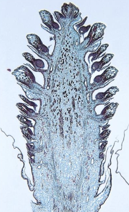 <p>Which structure is being shown?</p>