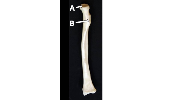<p>What type of bone marking is A? (hint: it’s in the antebrachial region)</p>