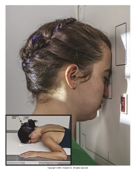 <p>What is the <u>positioning</u> of <strong>PA axial projection: Caldwell method </strong>for <strong>facial bone</strong>?</p>