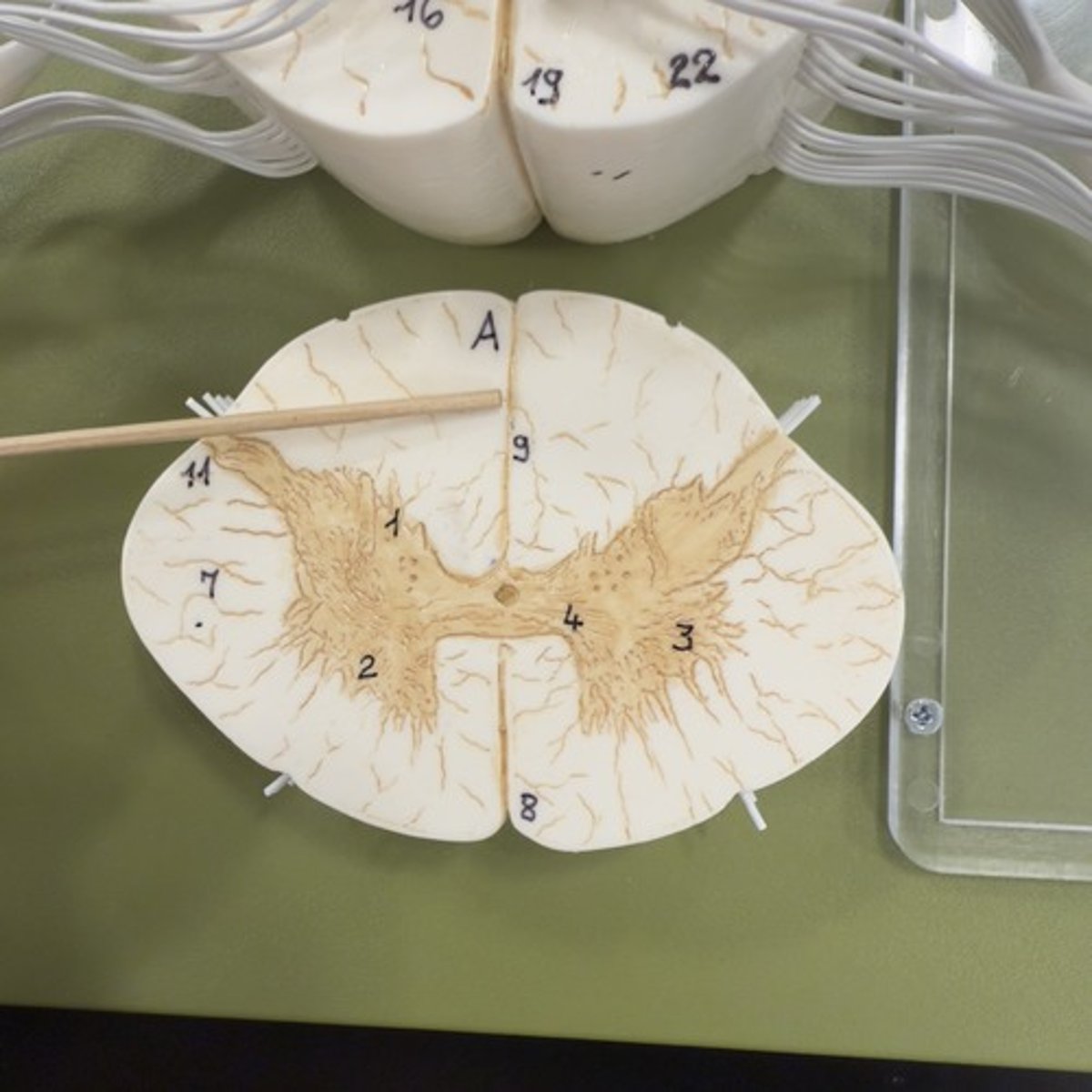 <p>Identify the structure.</p>