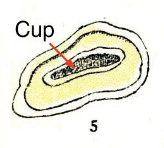 <p>Hollow upper portion of the in-folding infundibulum</p>