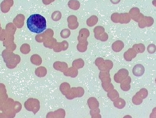 * stacking of RBCs in lines
* Nx in cats & horses
* Disperses in saline