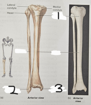 <p>What is structure #2?</p>