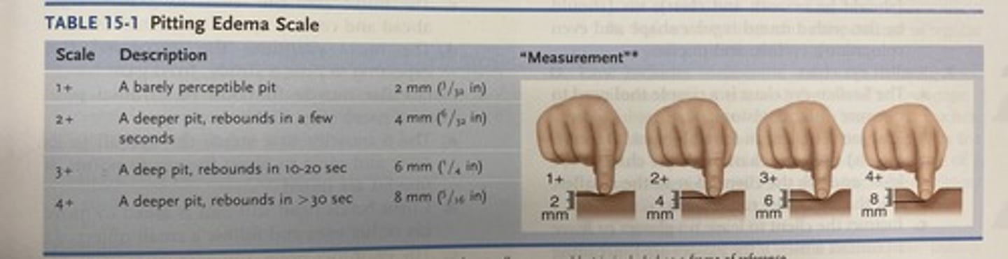 <p>1+ = barely perceptible pit- 2mm</p><p>2+ = a deeper pit, rebounds in a few seconds - 4mm</p><p>3+ = a deep pit, rebounds in 10-20 seconds - 6mm</p><p>4+ = deeper pit, rebounds in &gt; 30 seconds - 8mm</p>