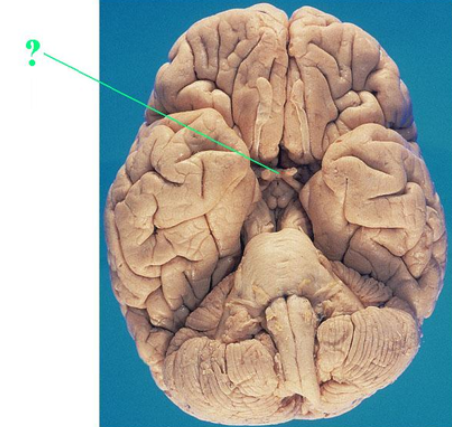 <p><span><span>Identify the indicated structure of the brain.</span></span></p>