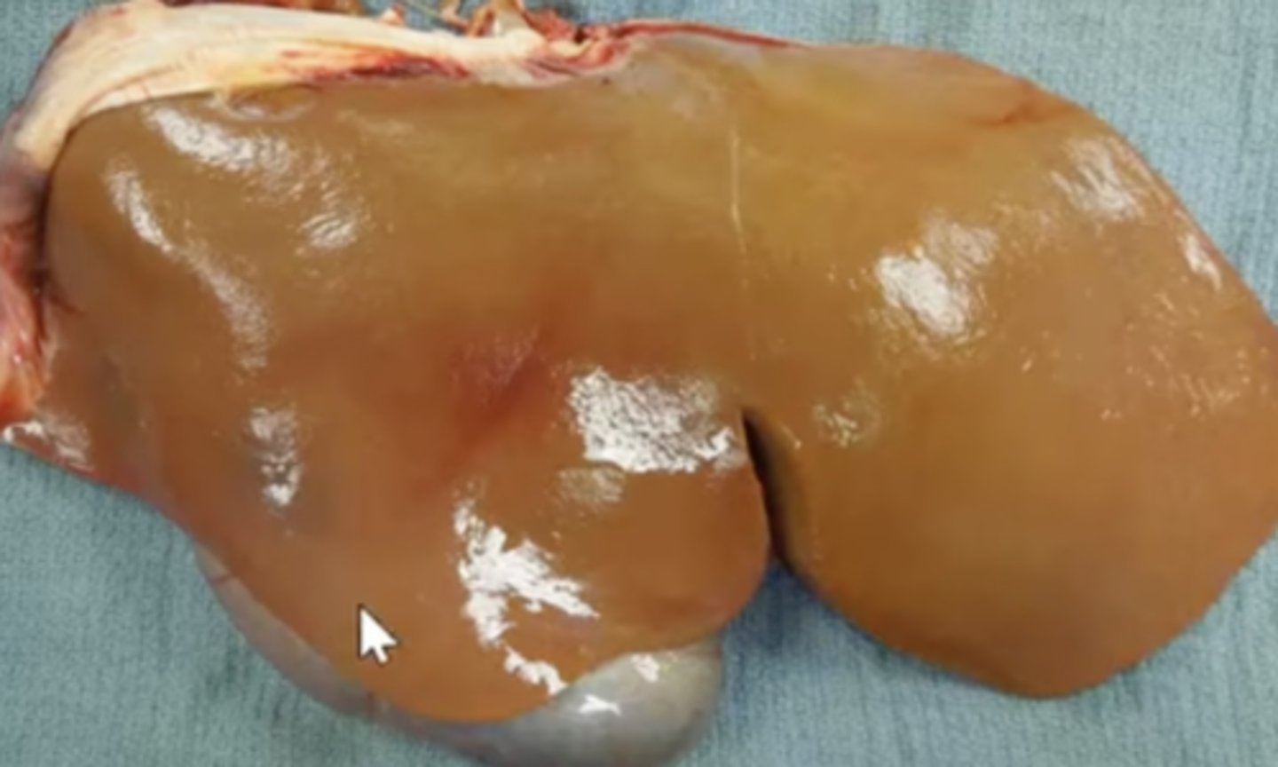 <p>What has caused this gross appearance of this sheep's liver</p>