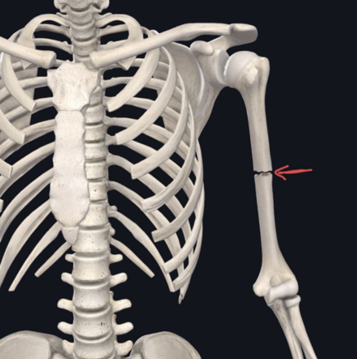 <p>Identify the plane of section in which the indicated fracture has occurred.</p>