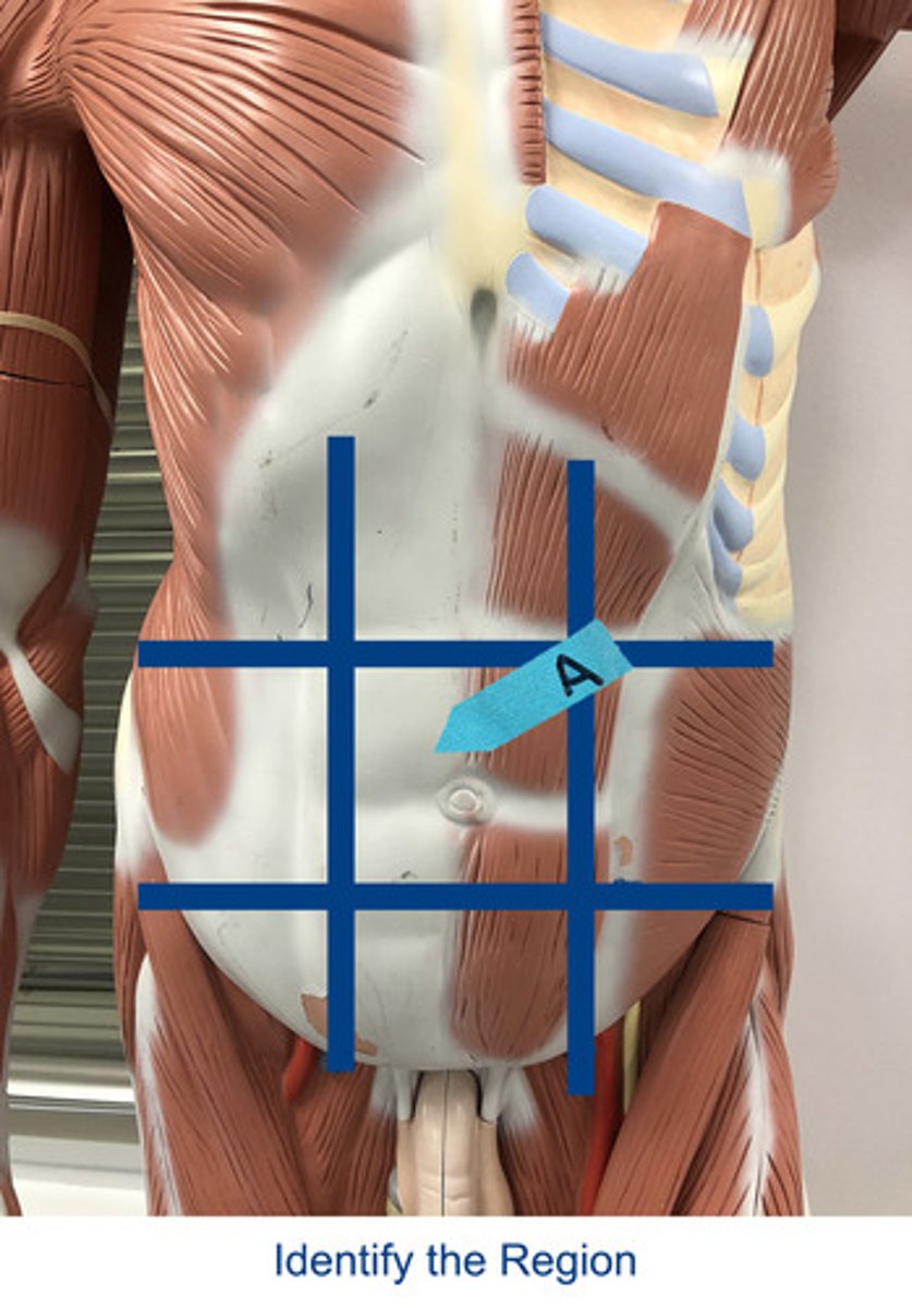 <p>Identify the area indicated by the arrow.</p>