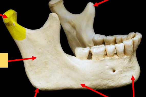 <p>What part of the bone is this?</p>