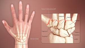 <p>wrist area</p>