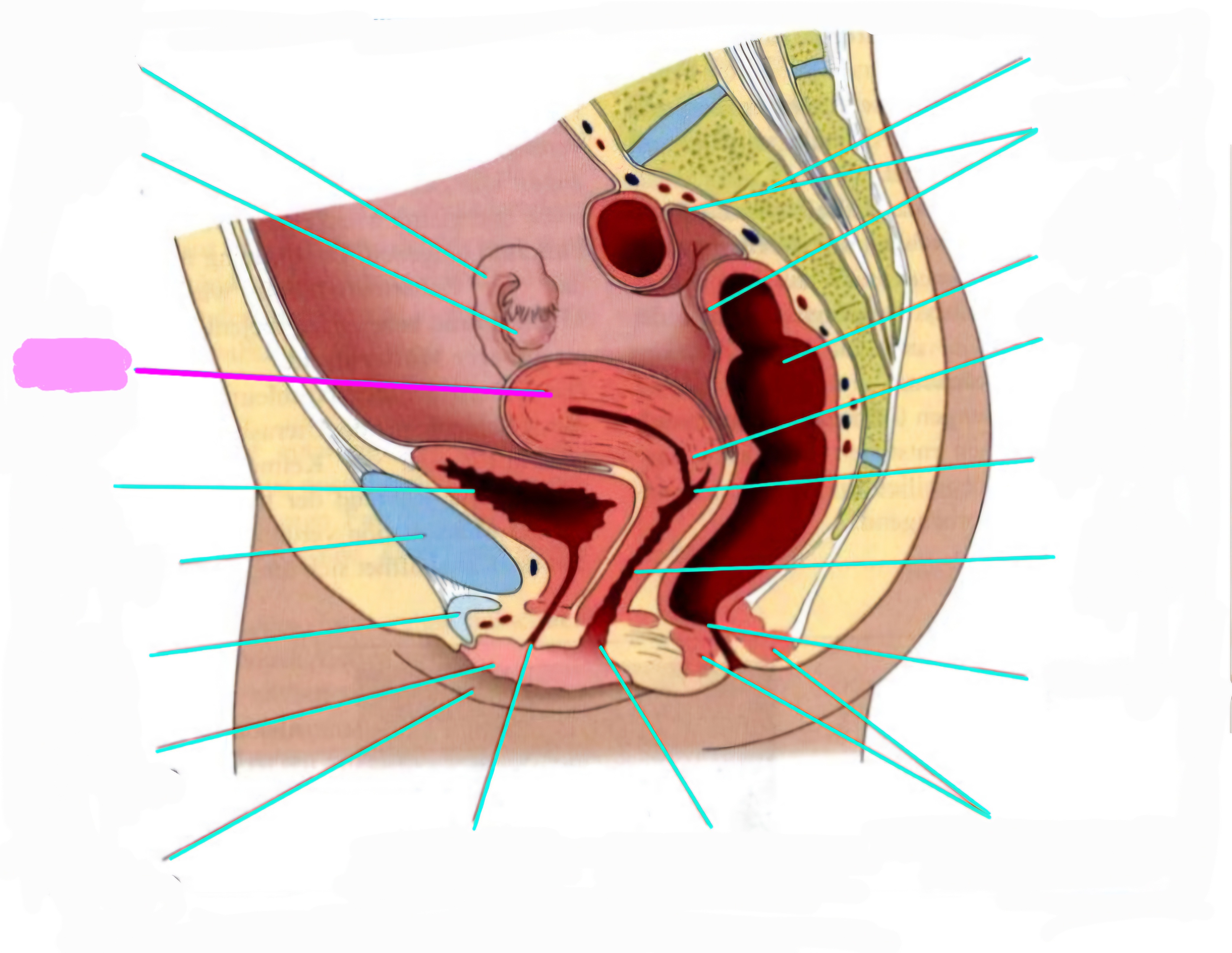 term image