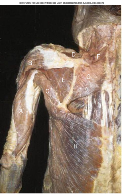 <p>What is E in the photo of posterior muscles?</p>