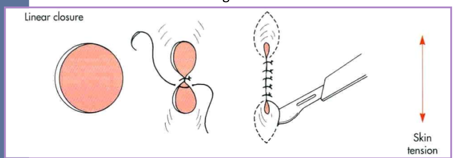 <p>irregular circular skin defects </p>