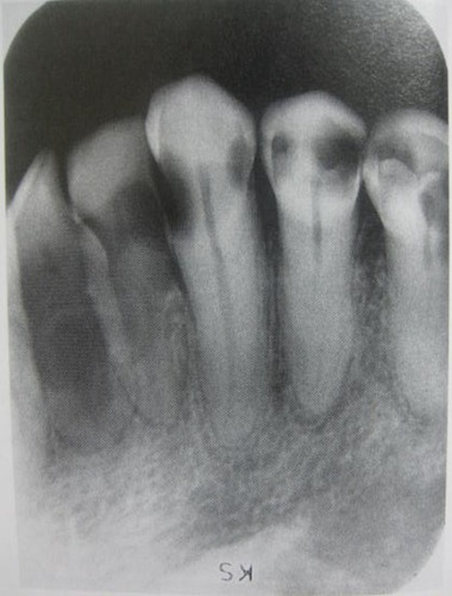 <p>Identify radiolucent area</p>
