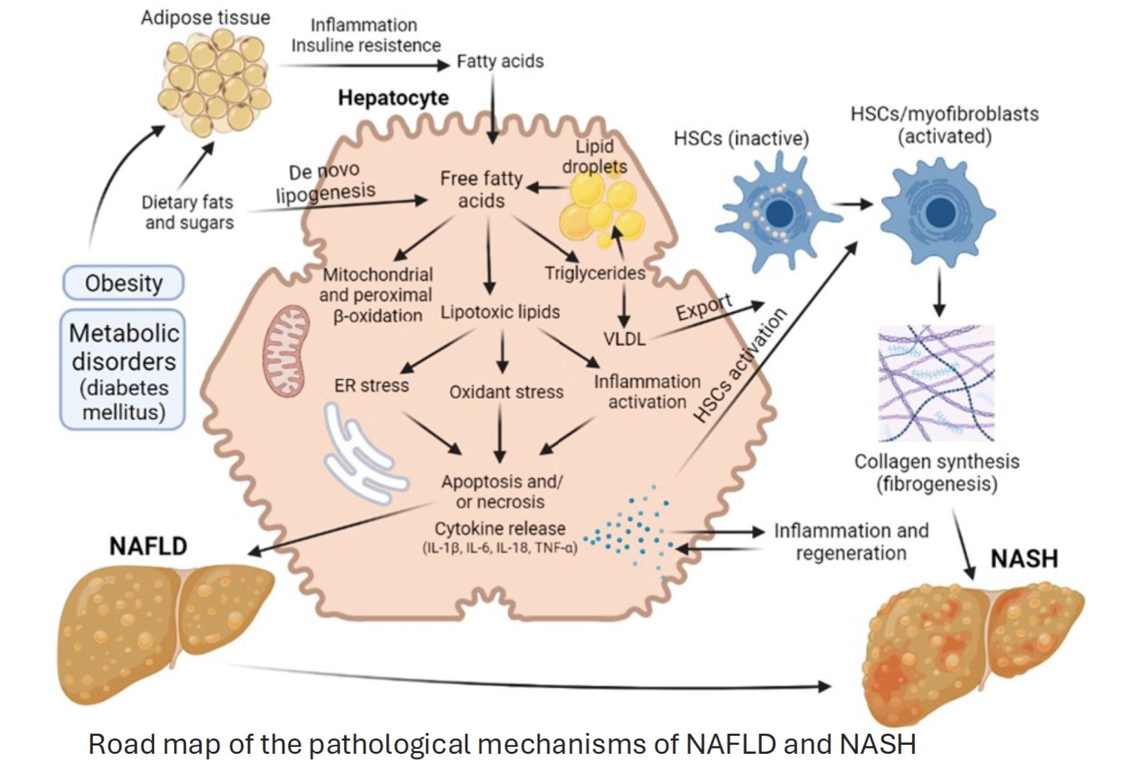 <p>Conditions eg. obesity or metabolic disorders leads to deposition of fats into adipose tissue</p><p>Free fatty acids normally used for lipid storage, but too much results in synthesis of lipotoxic lipids→ oxidative stress and inflammation, resulting in cell death and cytokine release → NAFLD → may progress to NASH (more severe form)</p><p>Inflammation can also activate HSCs, causing fibrosis → NASH</p>