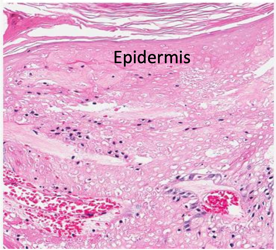 <p>what abnormal process is happening here?</p>