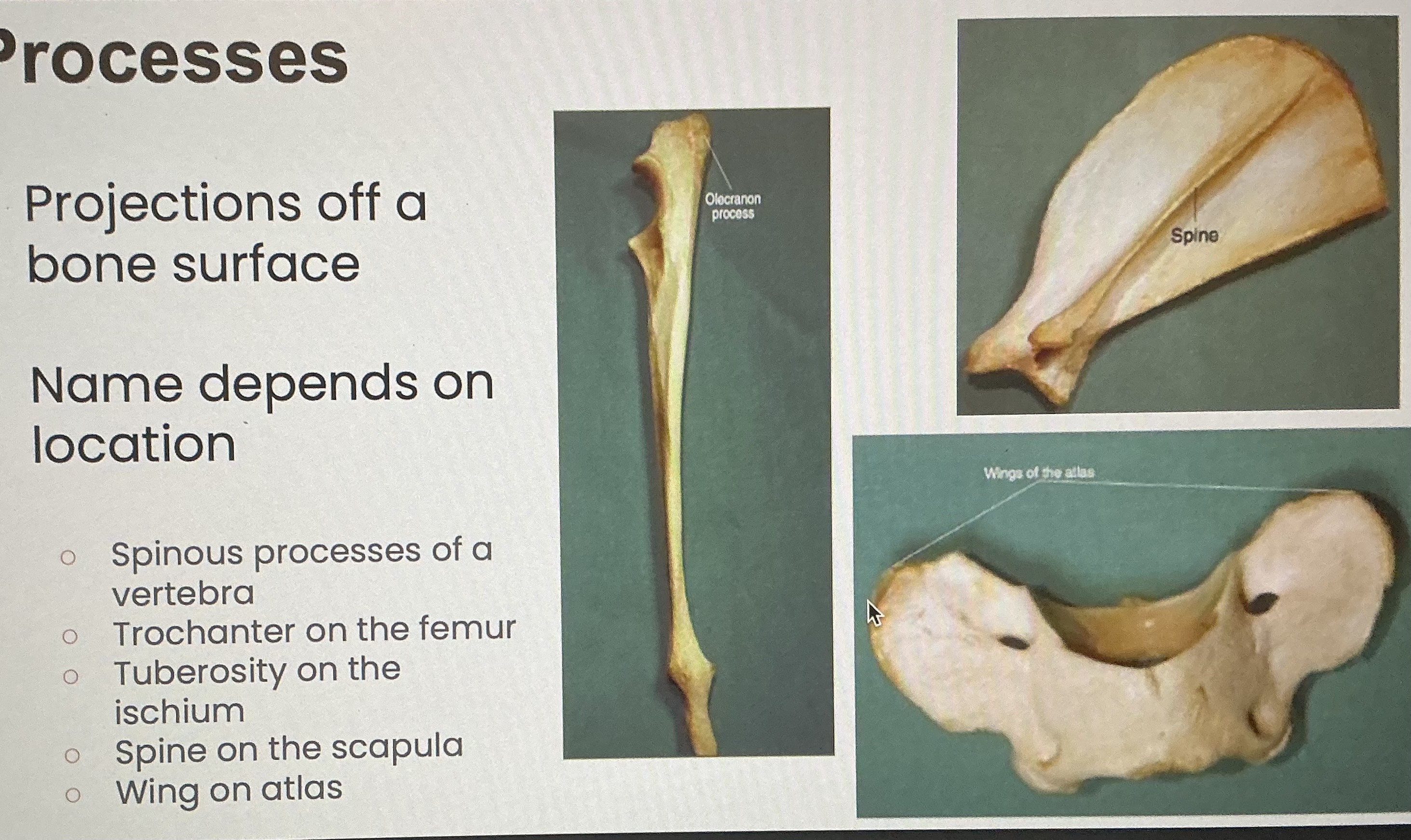 <p>Projections off a bone surface </p>
