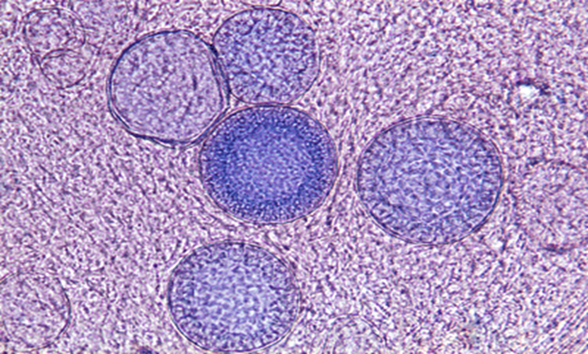 Spherules with endospores

  
