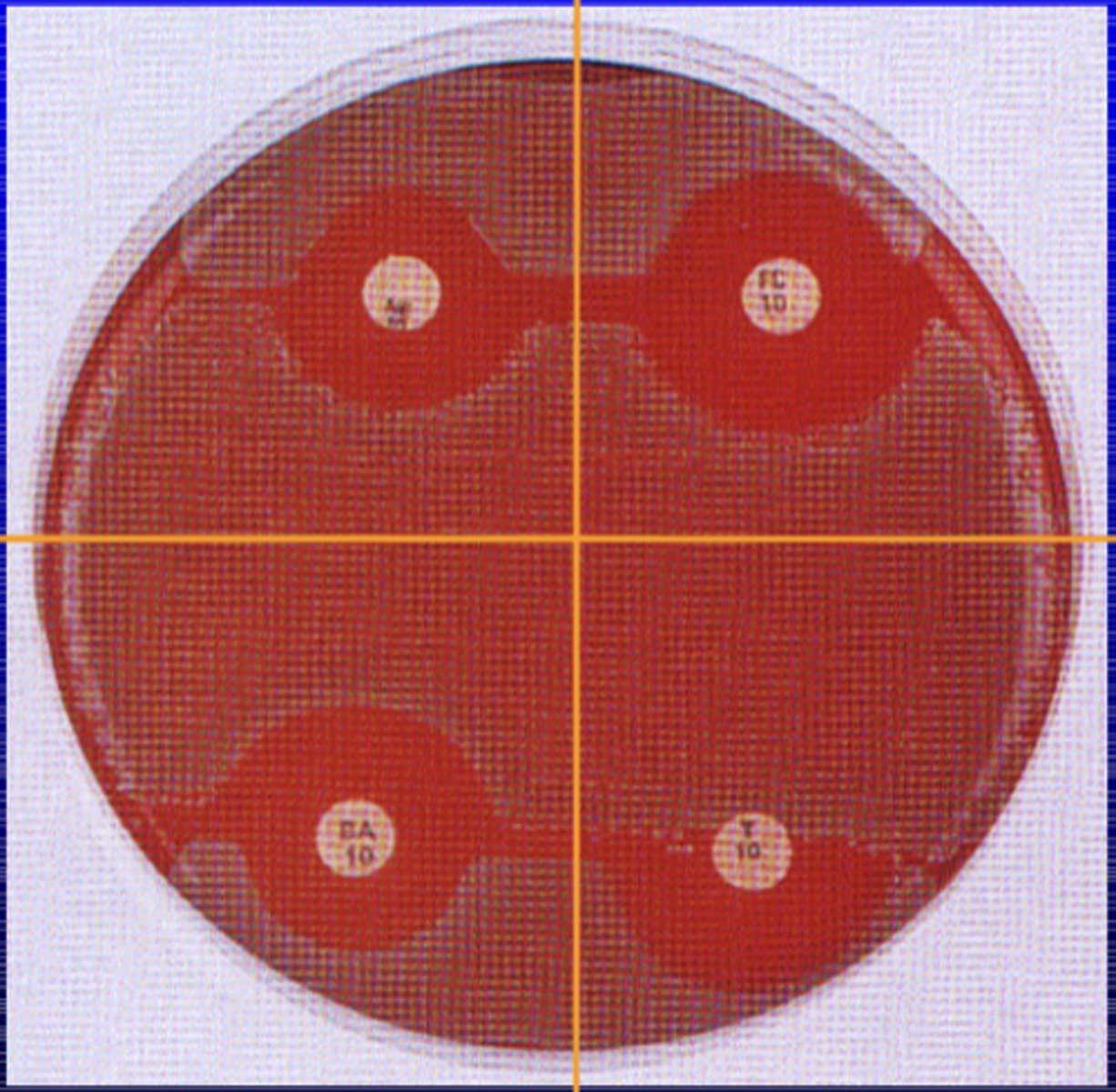 <p>disc diffusion</p>