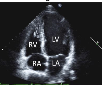 <p>what view is this</p>