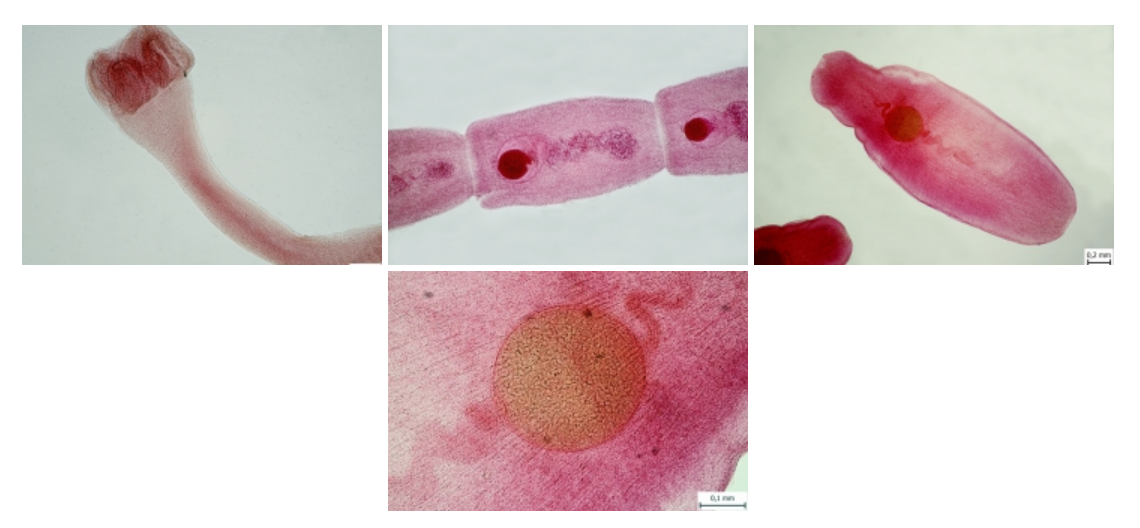 <p><strong>Mesocestoides lineatus </strong>- cyclophyllidae, cestode.</p><ul><li><p>4 distinct suckers, lacks hocks on rostelleum, single set of genital organs, parauterine organ (eggs mature here), reproductive organ is in middle of the proglottid.</p></li></ul><p></p>