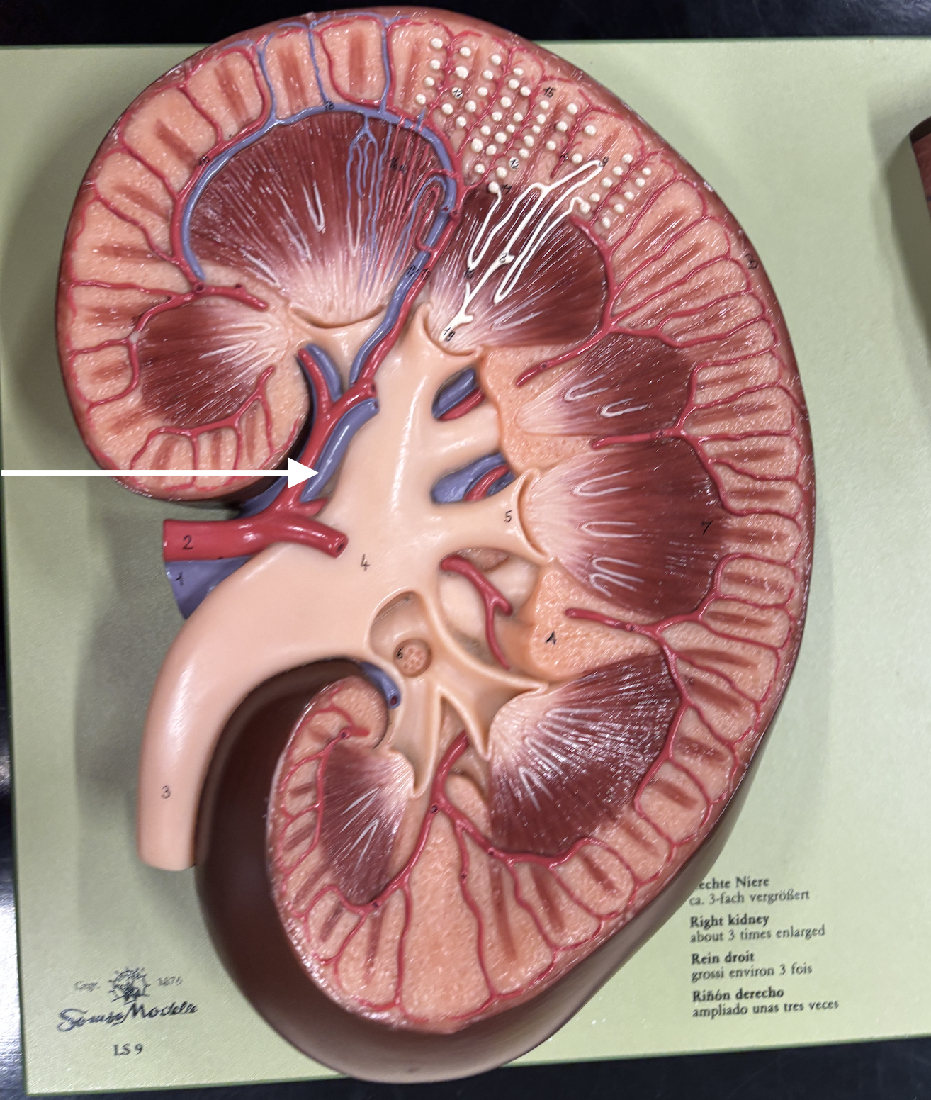 <p>what structure is the arrow pointing to? *vein*</p>