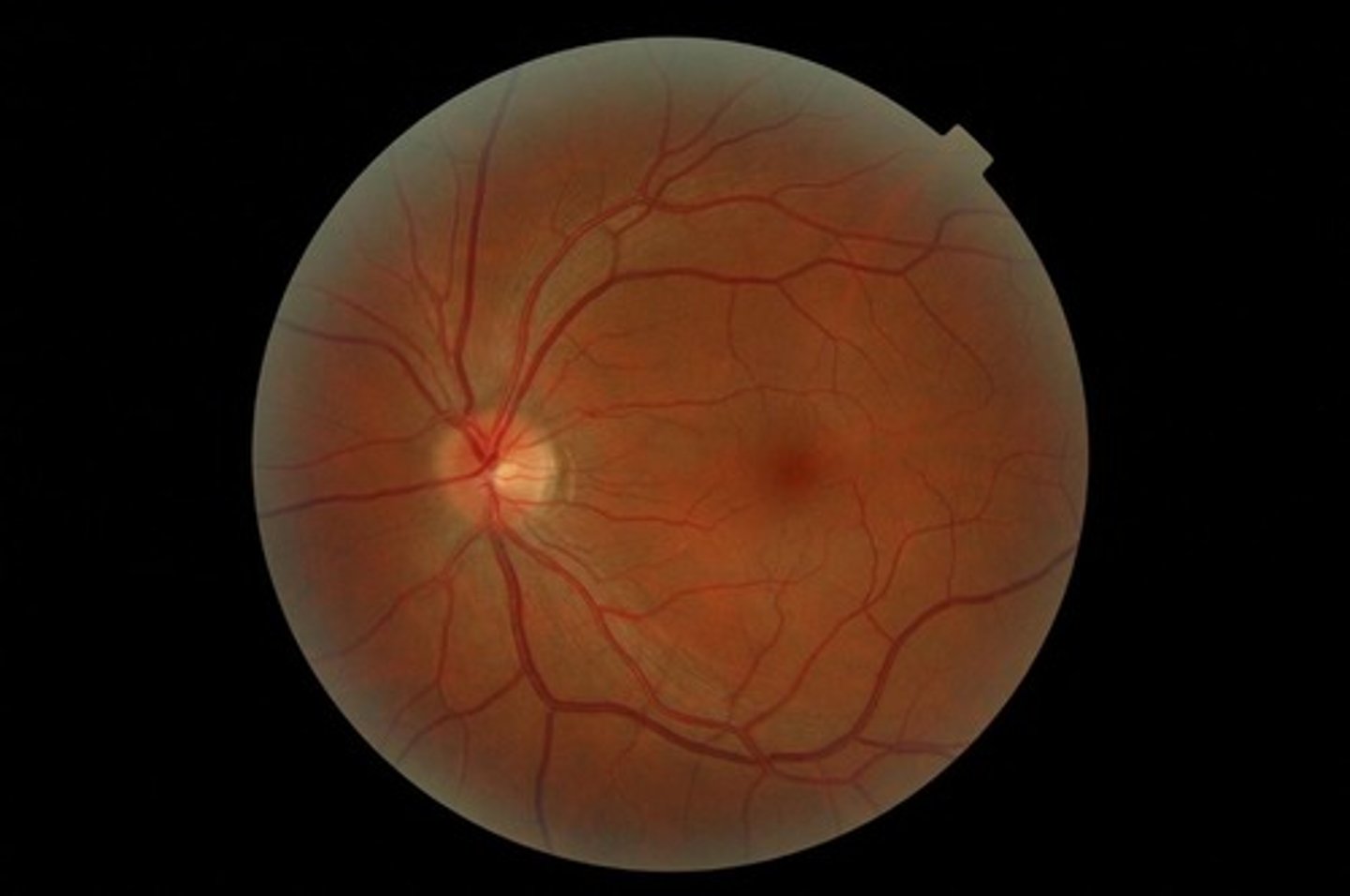 <p>the nerve that carries neural impulses from the eye to the brain.</p>