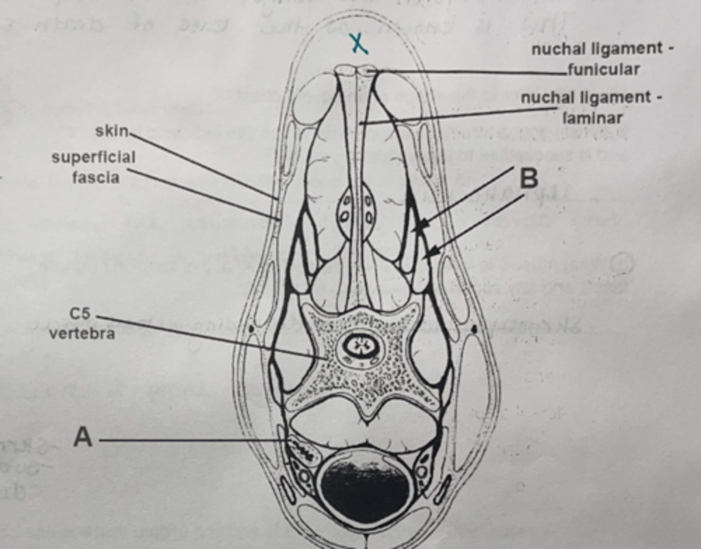 <p>What is indicated by X?</p>