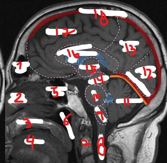 <p>12</p>