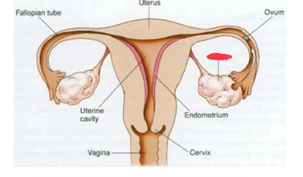 <p>Ovary</p>