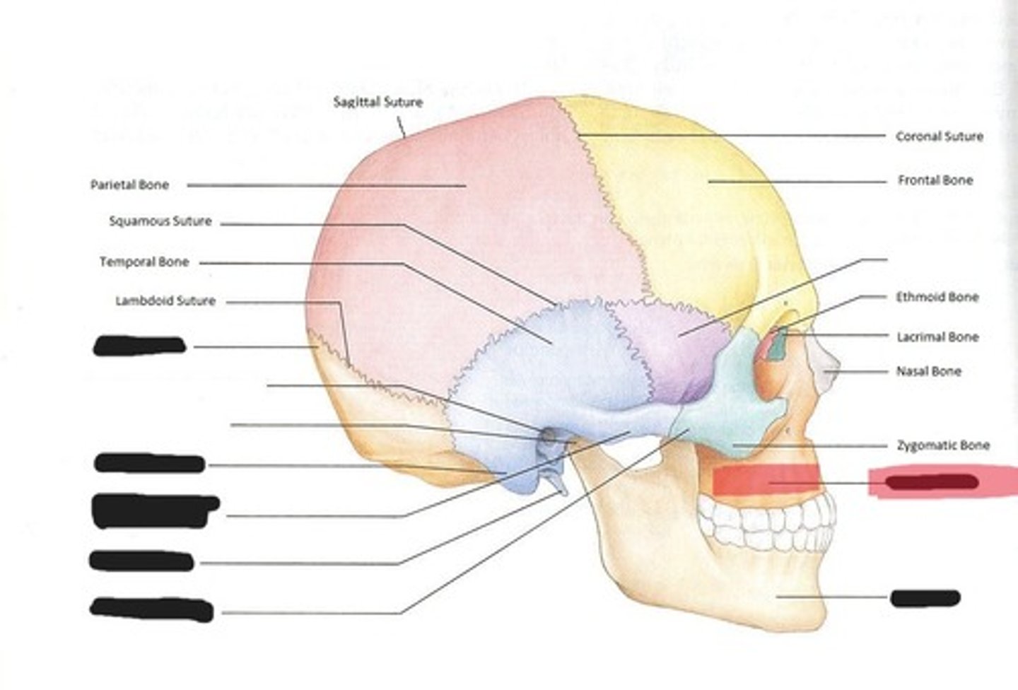 <p>Maxilla</p>