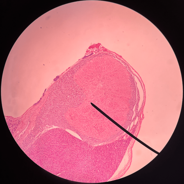 • The posterior lobe of the hypophysis.

• Composed of neurons originating in the hypothalamus.