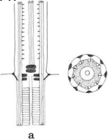 <p>double plate system of complex plates which are stacked on each other</p><p></p>