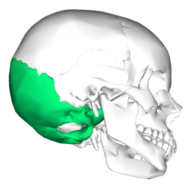 <p>(Cranium) What bone is this?</p>