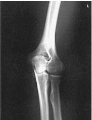 <p>What projection, position, and anatomy is this?</p>