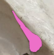 <p>Narrow slit like opening for vessels and nerves</p>