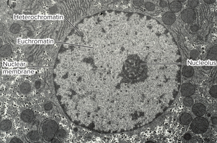 <ul><li><p>regions that are stained throughout cell cycle</p></li><li><p>greater level of compaction</p></li><li><p>localized along periphery of nucleus; attached to nuclear lamina</p></li><li><p>Gene silencing: inhibition of transcription; may limit access of activators or other aspects of transcription</p></li><li><p>Prevention of transposable element movement: genes needed for transposition are silenced</p></li><li><p>Prevention of viral proliferation: genes needed to produce more viruses are silenced</p></li></ul><p></p>