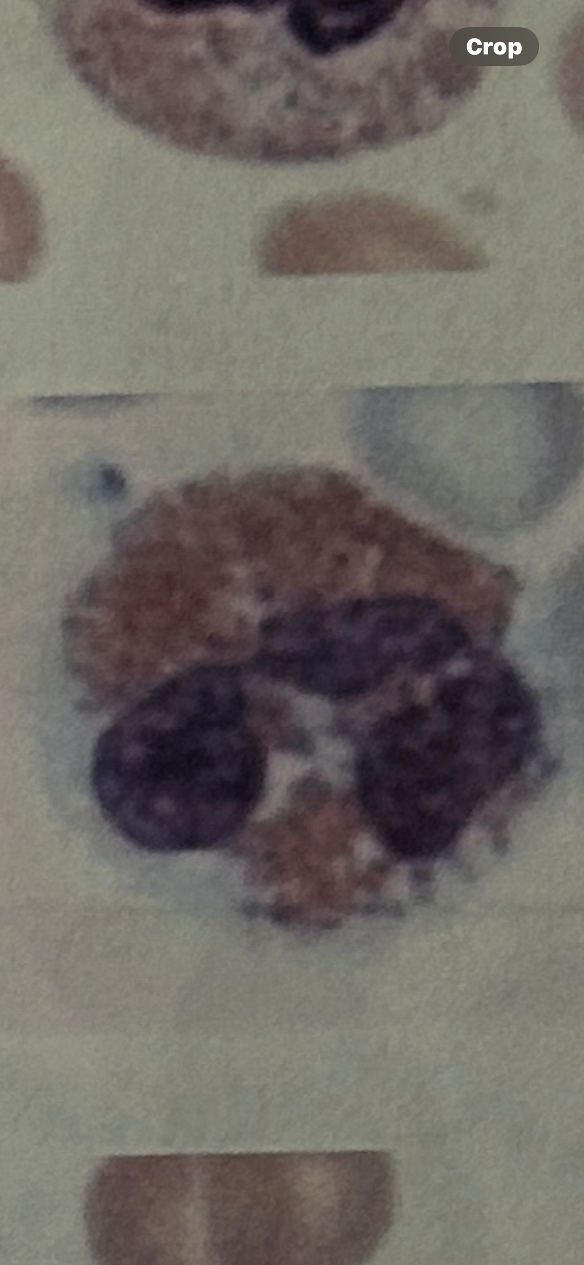 <p>WBC</p>