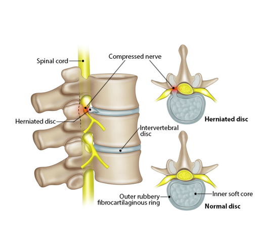 <p>-inner portion of the disc</p><p>-elastic and compressible</p>