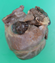 <p>Describe this pathology</p>