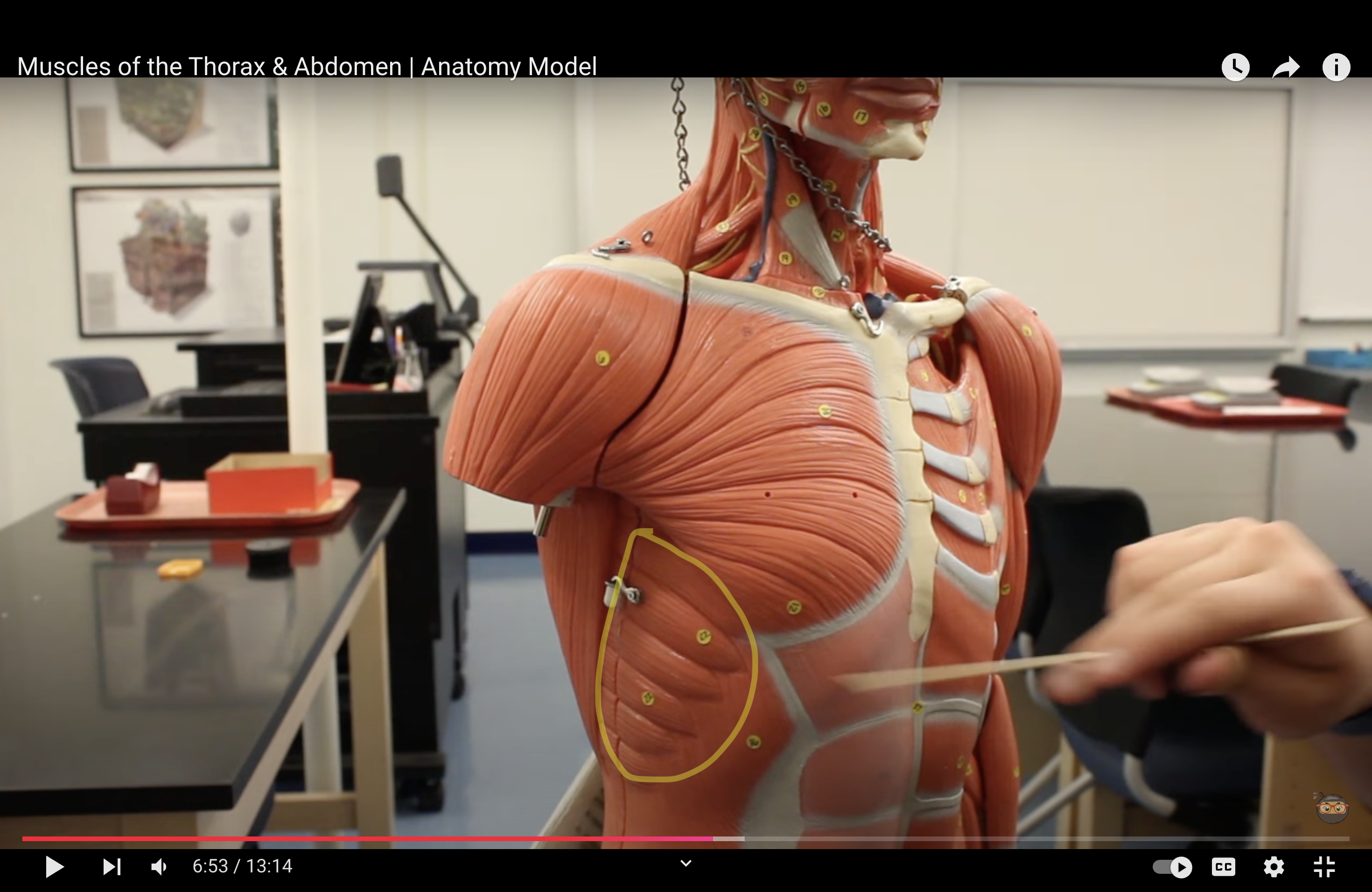 <p>What muscle is this?*****</p>