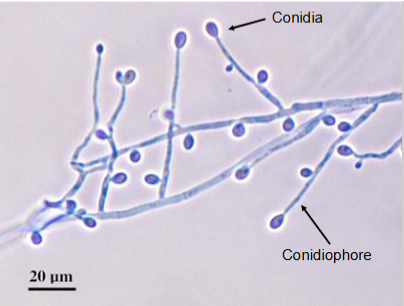 <ul><li><p><span>Septate hyphae</span></p></li><li><p><span>Conidiophores produce single conidia</span></p></li><li><p><span>Conidia appear cut off at base</span></p><ul><li><p><span>Flattened end/truncate</span></p></li></ul></li></ul><p></p>
