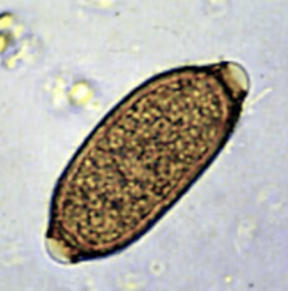 <p>this egg belongs to what genus?</p>