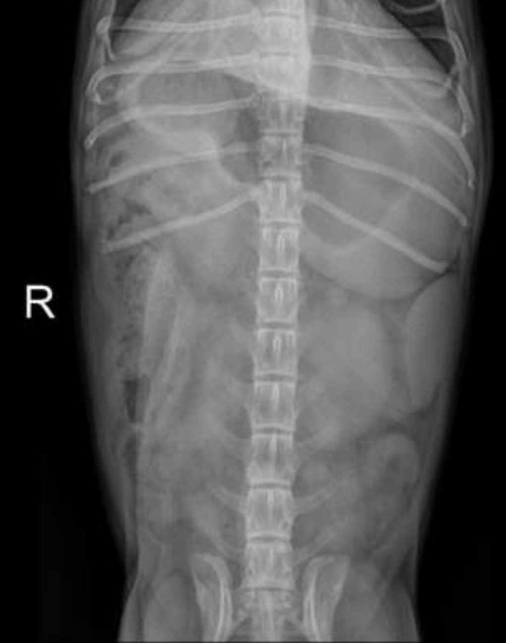 <p>This is a ventro-dorsal radiograph of a canine patient presenting with vomiting &amp; lethargy. What makes this view of poor quality for interpretation?</p>