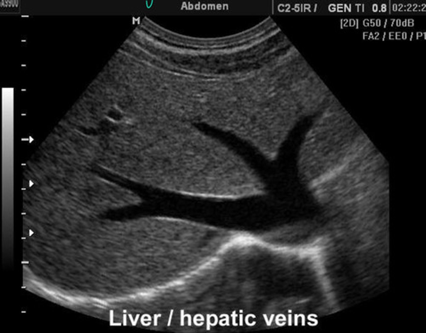 <p>What is going on here? Is this normal or abnormal?</p>