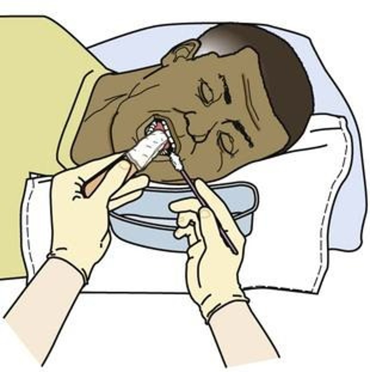 <p>Use two nurses for safety, inspect the oral cavity, and avoid inserting fingers into the mouth.</p>